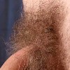 massive genital hair